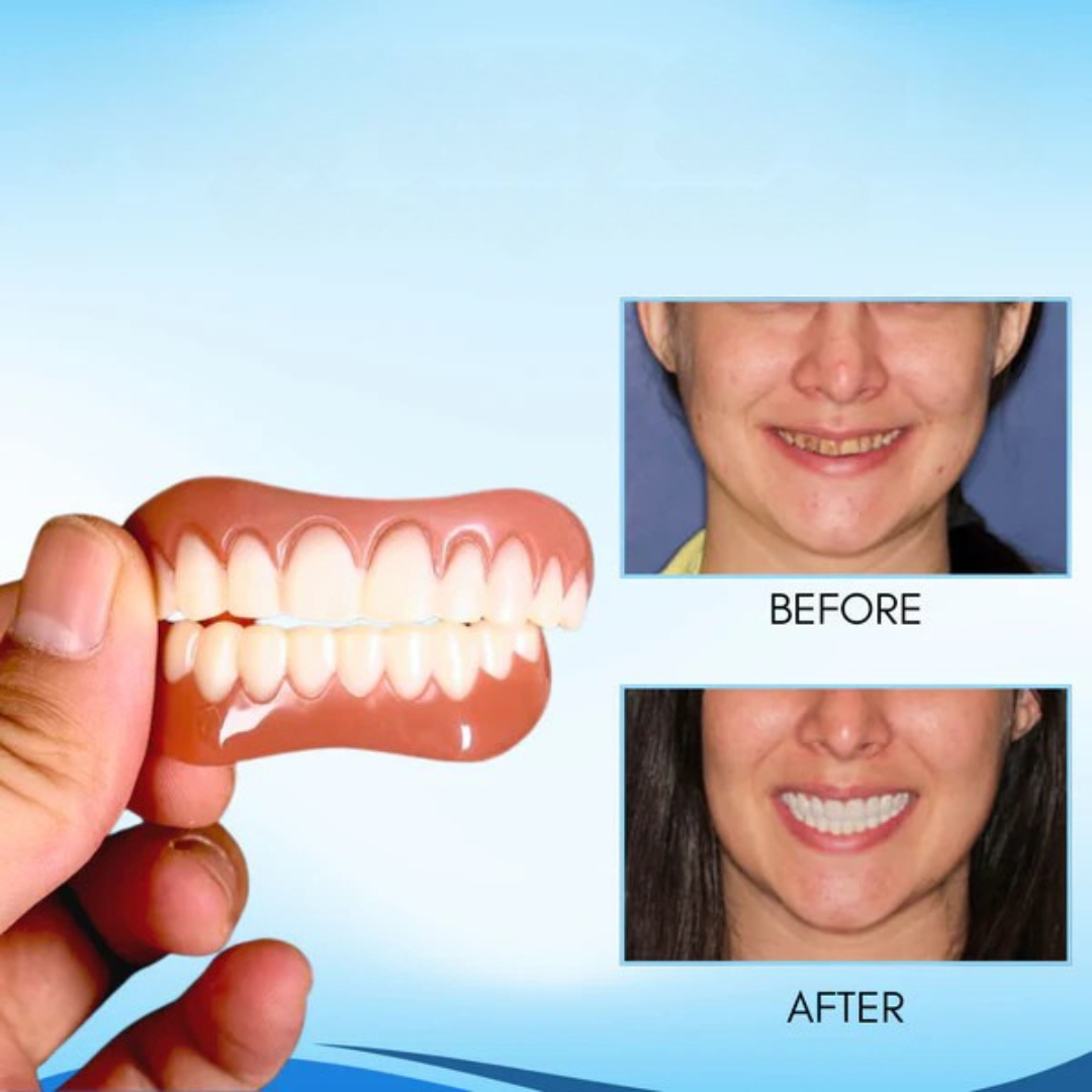 Get a confident smile without the dentist | SnapTeeth | Buy 1 Get 1 Free