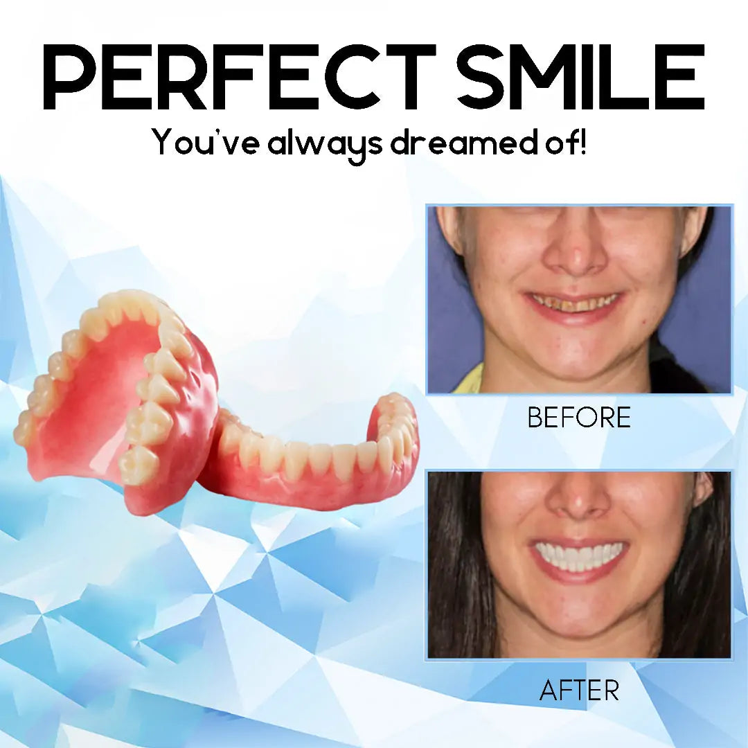 A naturally looking white smile without a dentist | PerfectSmile™