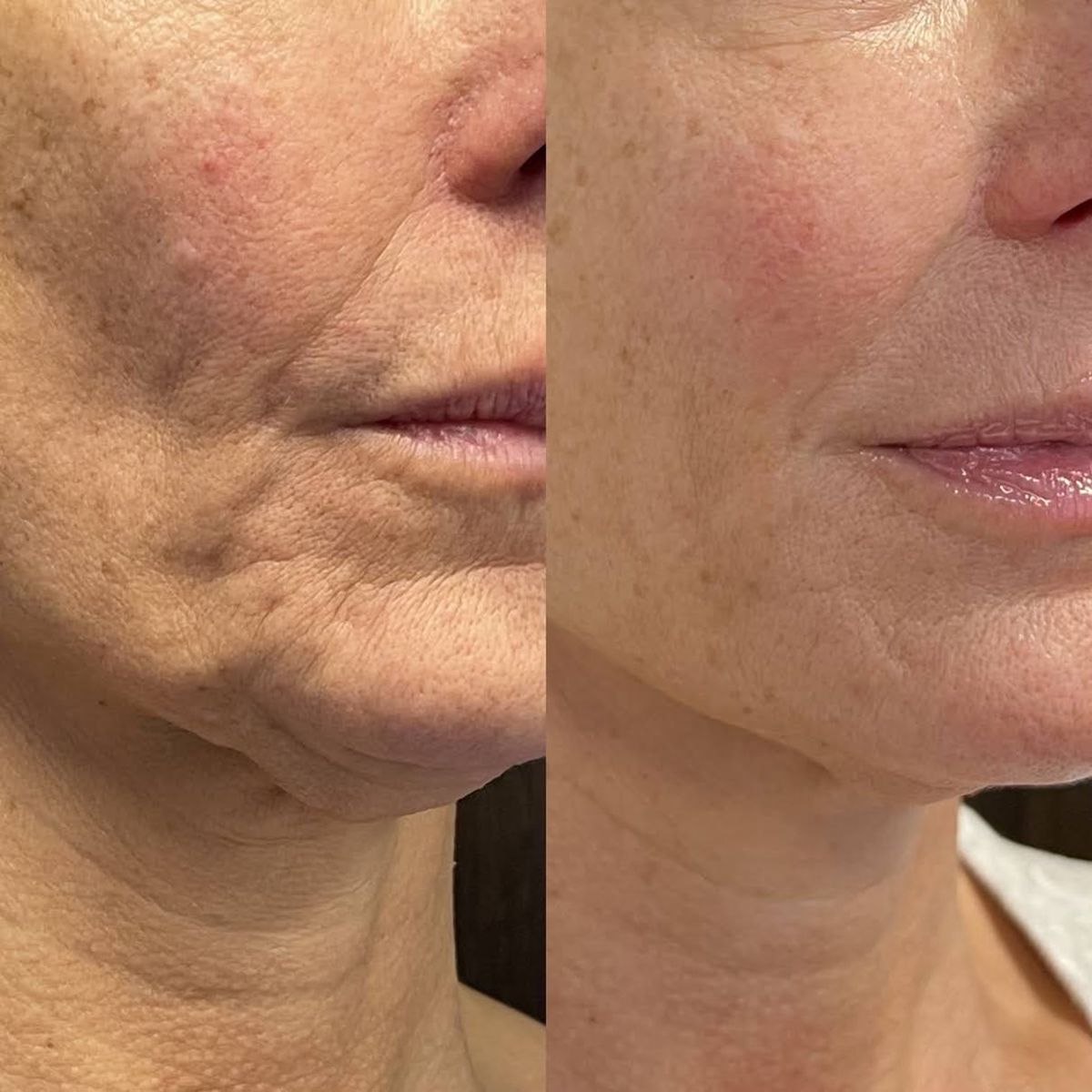 Nectaré Stick Siero Anti-Età