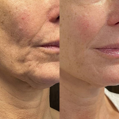 Nectaré Stick Siero Anti-Età