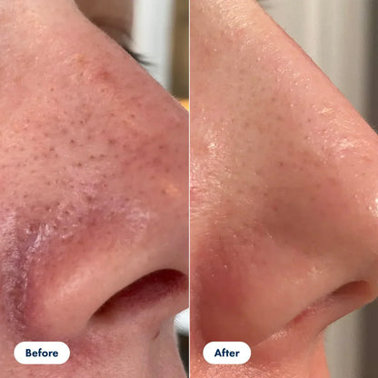 Glyssa™ – Siero coreano Poreless Glass Skin