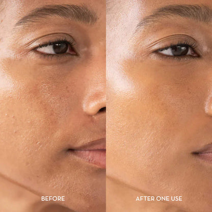 Glyssa™ – Siero coreano Poreless Glass Skin