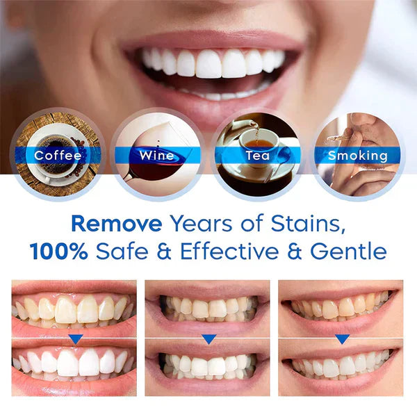Achieve a visibly whiter smile at home, pain-free | WhiteSmile™ | Buy 1 Get 1 FREE