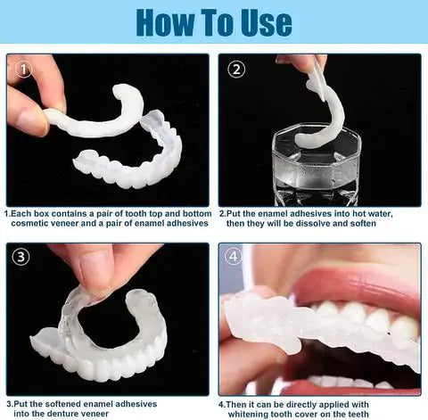 A naturally looking white smile without a dentist | PerfectSmile™