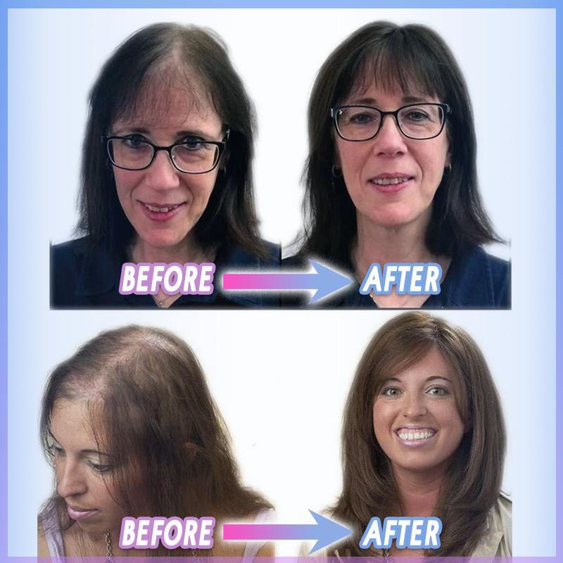 Magical Clip-On Hair Topper | PerfectHair™