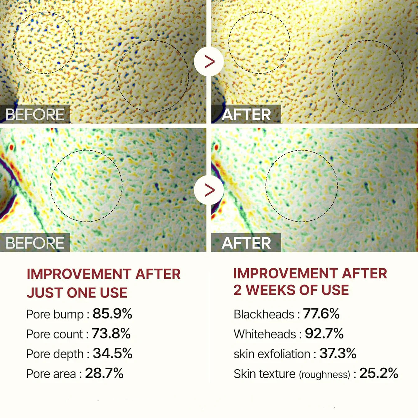 Glyssa™ – Siero coreano Poreless Glass Skin