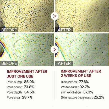 Glyssa™ – Siero coreano Poreless Glass Skin
