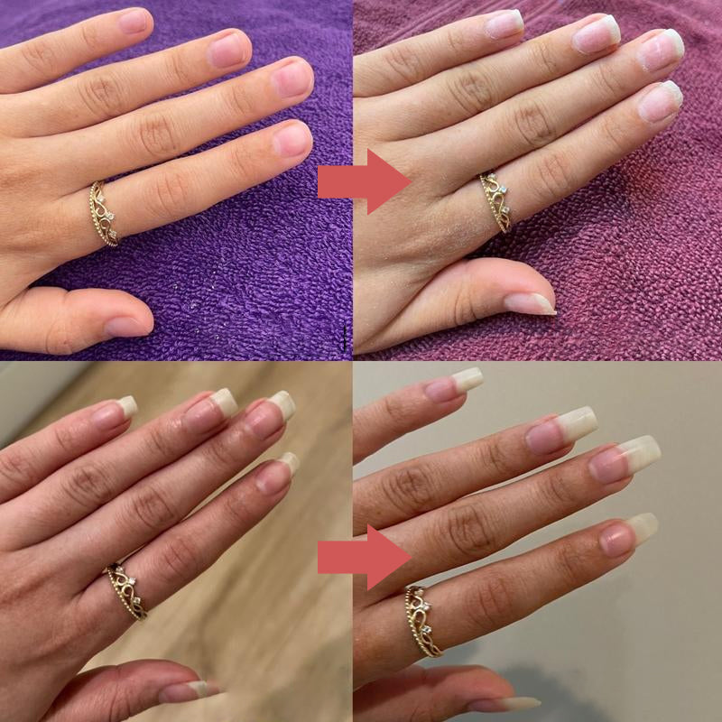 NailRevive™ - Unghie più forti e sane in poche settimane