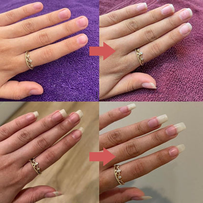 NailRevive™ - Unghie più forti e sane in poche settimane