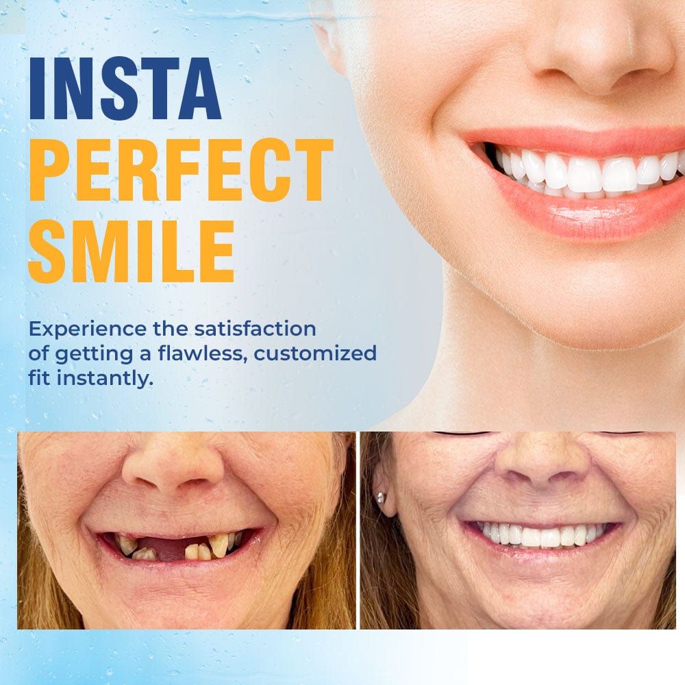 A naturally looking white smile without a dentist | PerfectSmile™