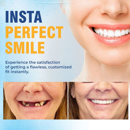 A naturally looking white smile without a dentist | PerfectSmile™