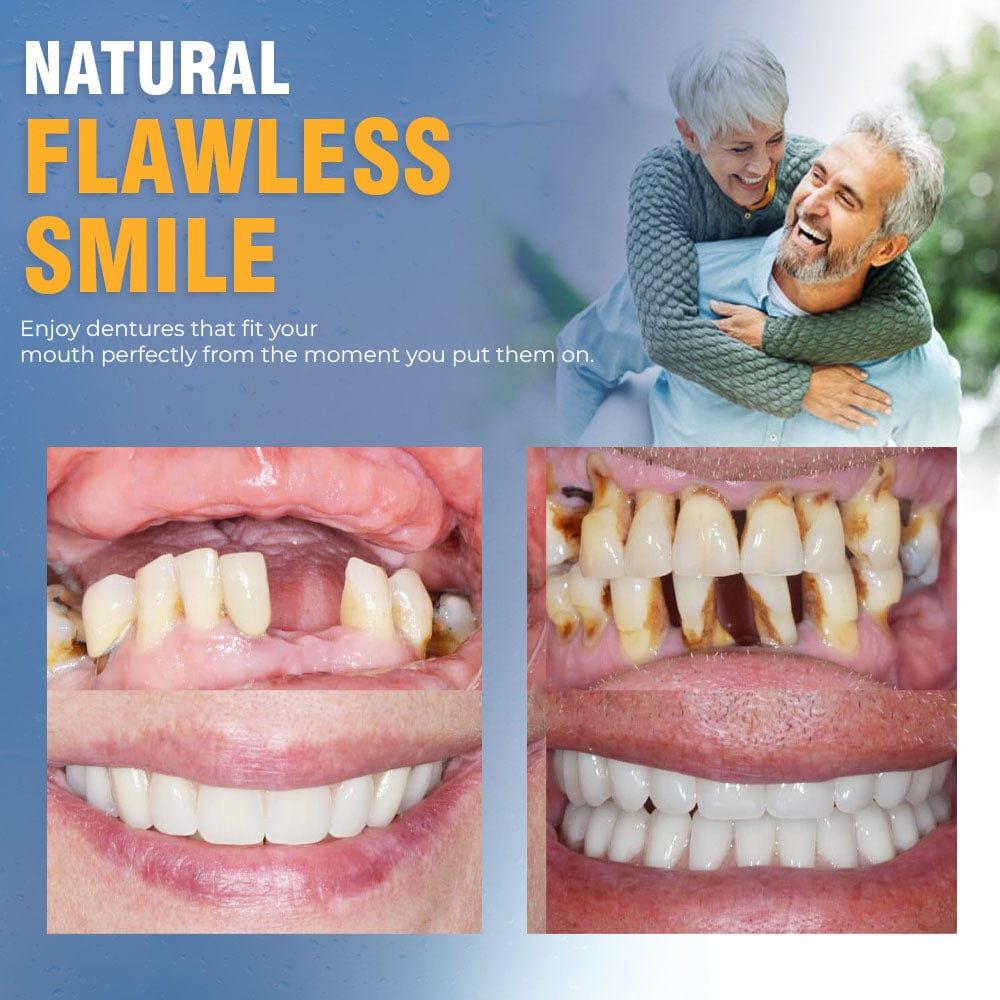 A naturally looking white smile without a dentist | PerfectSmile™